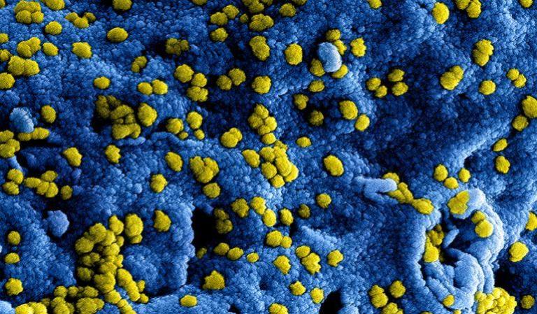 Inhoud tweede steunpakket Ministerie OCW